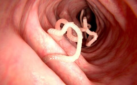 Vermi nel corpo umano