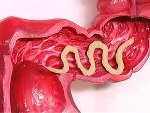 Parassiti nel corpo umano, perché appaiono