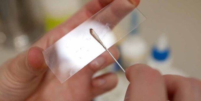 Raschiamento della pelle per parassiti