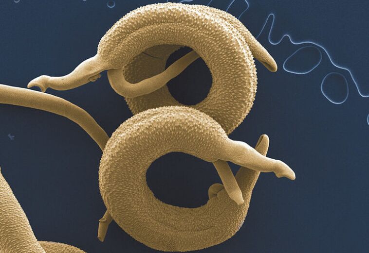 Parassiti che vivono nel corpo umano